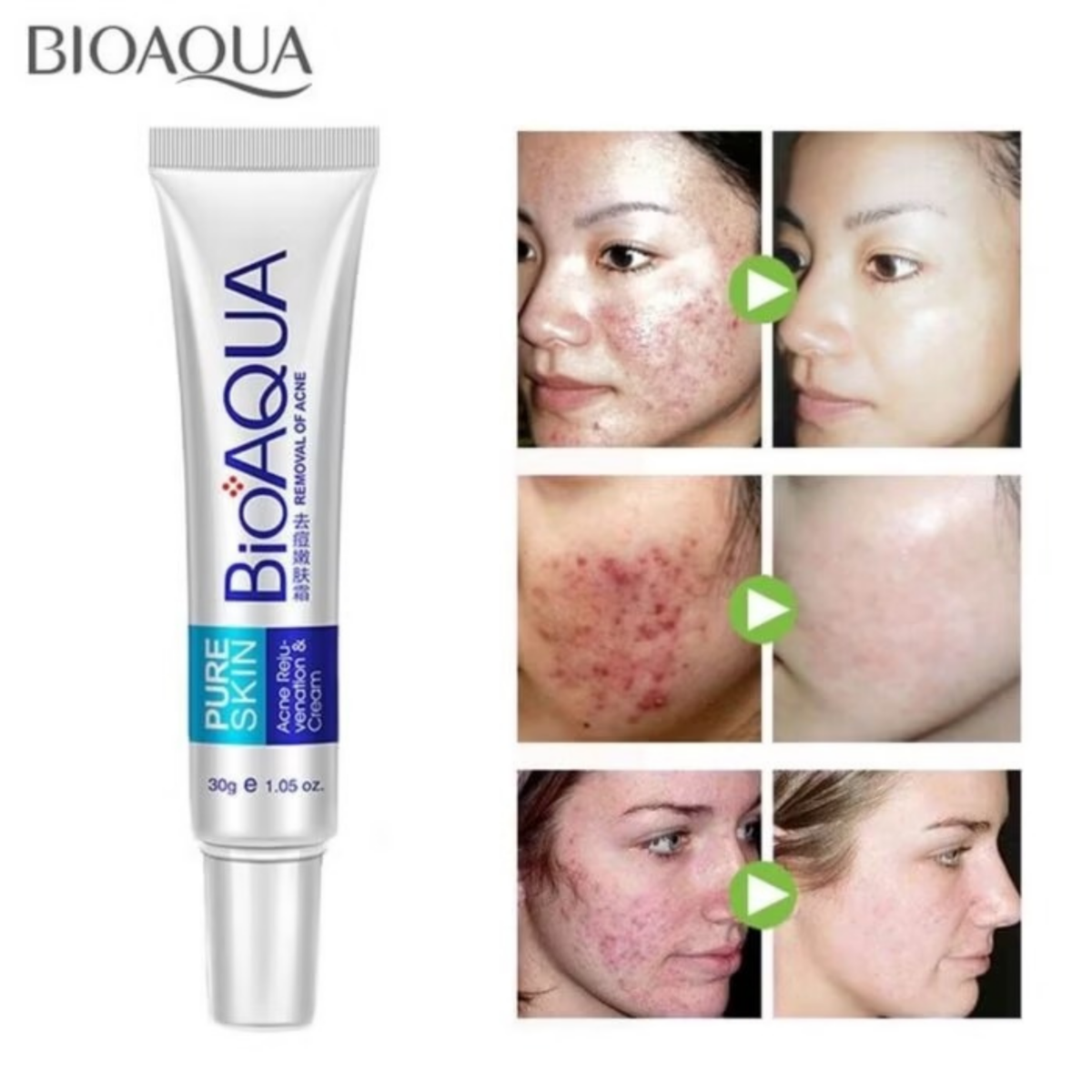 BIOAQUA Acne Removing & Rejuvenating Cream – Pure Skin Formula