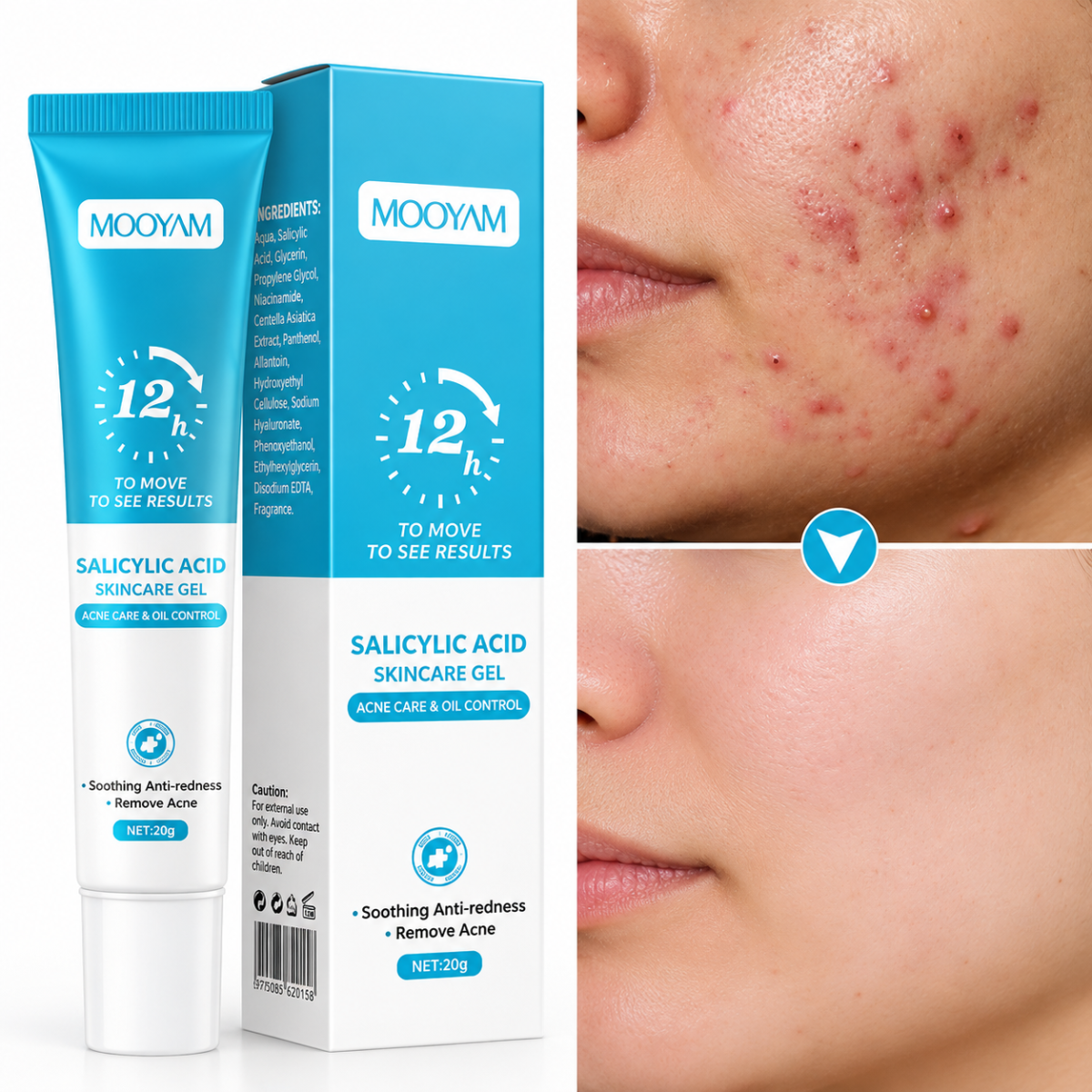 mooyom MOOYAM Dark Spot Removal Cream