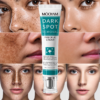 mooyom 2 MOOYAM Dark Spot Removal Cream